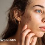 5 consejos de expertos para que los adolescentes cuiden su piel