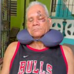 Hombre pierde un ojo tras ser agredido a botellazos por dos jóvenes en La Guáyiga