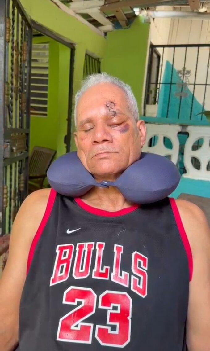 Hombre pierde un ojo tras ser agredido a botellazos por dos jóvenes en La Guáyiga