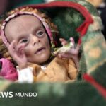 "Solo piel y huesos": los gemelos recién nacidos que tratan de sobrevivir a la guerra y el hambre en Yemen