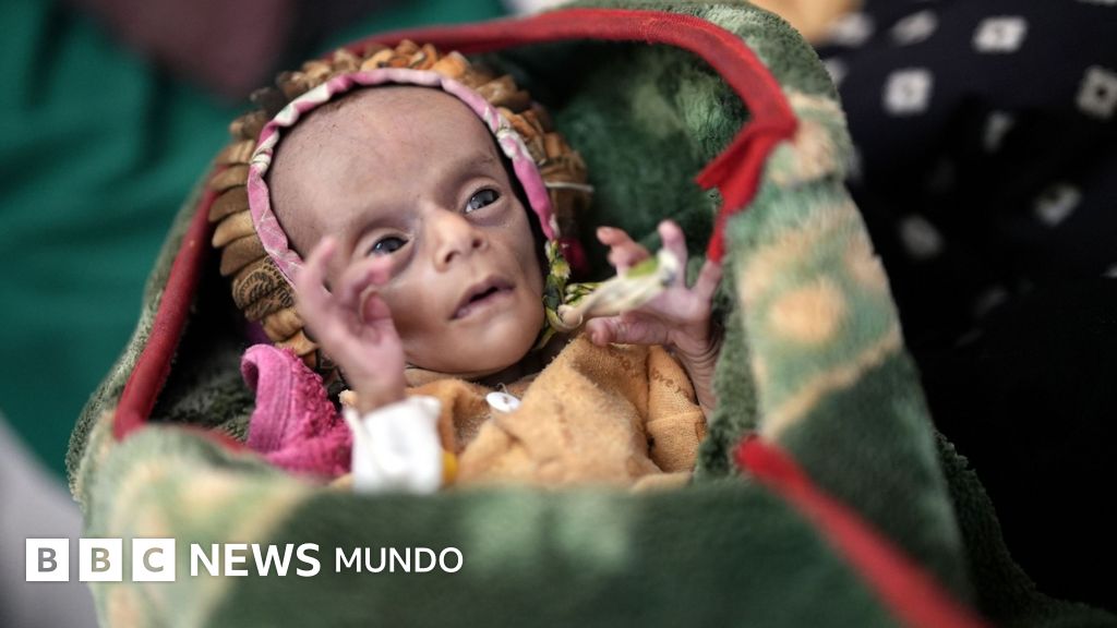 "Solo piel y huesos": los gemelos recién nacidos que tratan de sobrevivir a la guerra y el hambre en Yemen