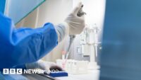 Qué es y cómo se propaga la peste neumónica que se estudia en el laboratorio de Siberia en el que falleció una trabajadora